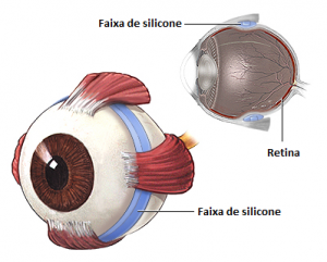 Figura 4 (imagem meramente ilustrativa) Fonte: www.nlm.nih.gov/medlineplus 